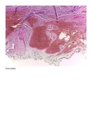 OTRA LAMINA
 
