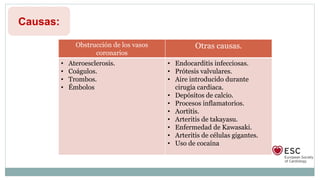 Causas:
Obstrucción de los vasos
coronarios
Otras causas.
• Ateroesclerosis.
• Coágulos.
• Trombos.
• Émbolos
• Endocarditis infecciosas.
• Prótesis valvulares.
• Aire introducido durante
cirugía cardiaca.
• Depósitos de calcio.
• Procesos inflamatorios.
• Aortitis.
• Arteritis de takayasu.
• Enfermedad de Kawasaki.
• Arteritis de células gigantes.
• Uso de cocaína
 