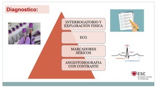 INTERROGATORIO Y
EXPLORACIÓN FISICA
ECG
MARCADORES
SÉRICOS
ANGIOTOMOGRAFIA
CON CONTRASTE
Diagnostico:
 