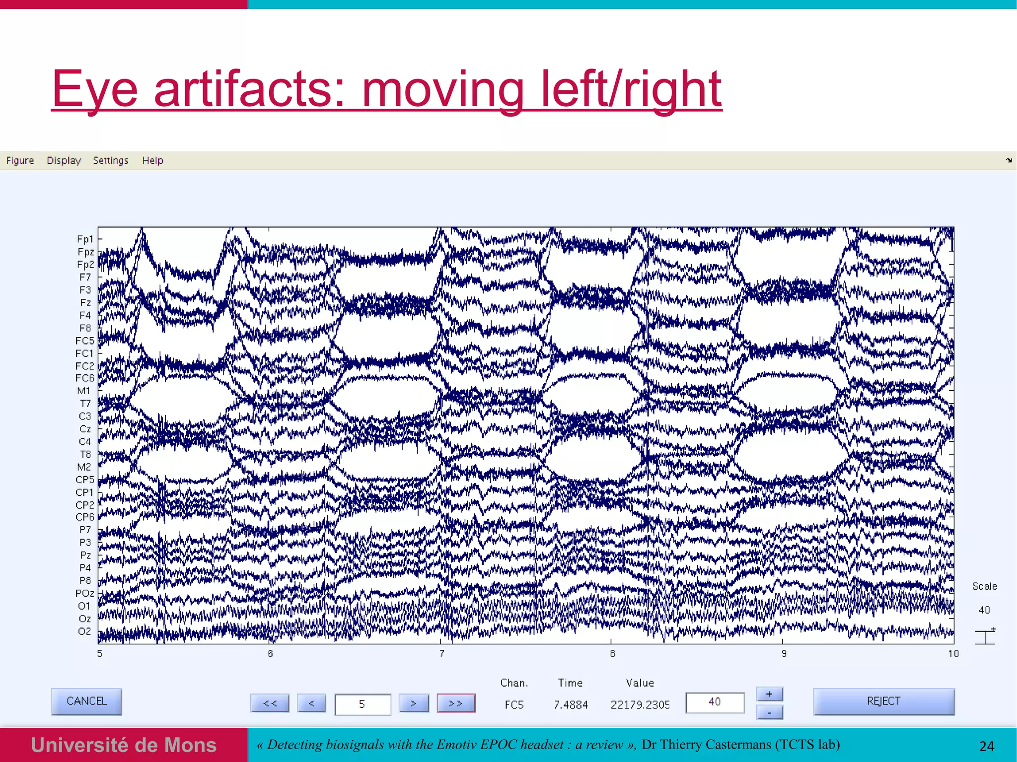 @
1 


6%
	

A
       % 