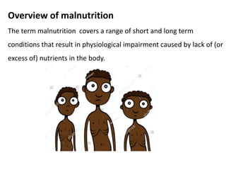 Overview of malnutrition
The term malnutrition covers a range of short and long term
conditions that result in physiological impairment caused by lack of (or
excess of) nutrients in the body.
 
