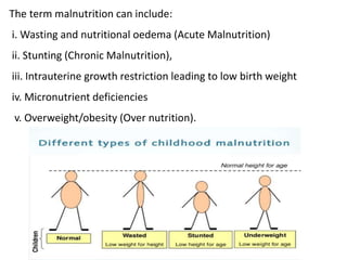 The term malnutrition can include:
i. Wasting and nutritional oedema (Acute Malnutrition)
ii. Stunting (Chronic Malnutrition),
iii. Intrauterine growth restriction leading to low birth weight
iv. Micronutrient deficiencies
v. Overweight/obesity (Over nutrition).
 