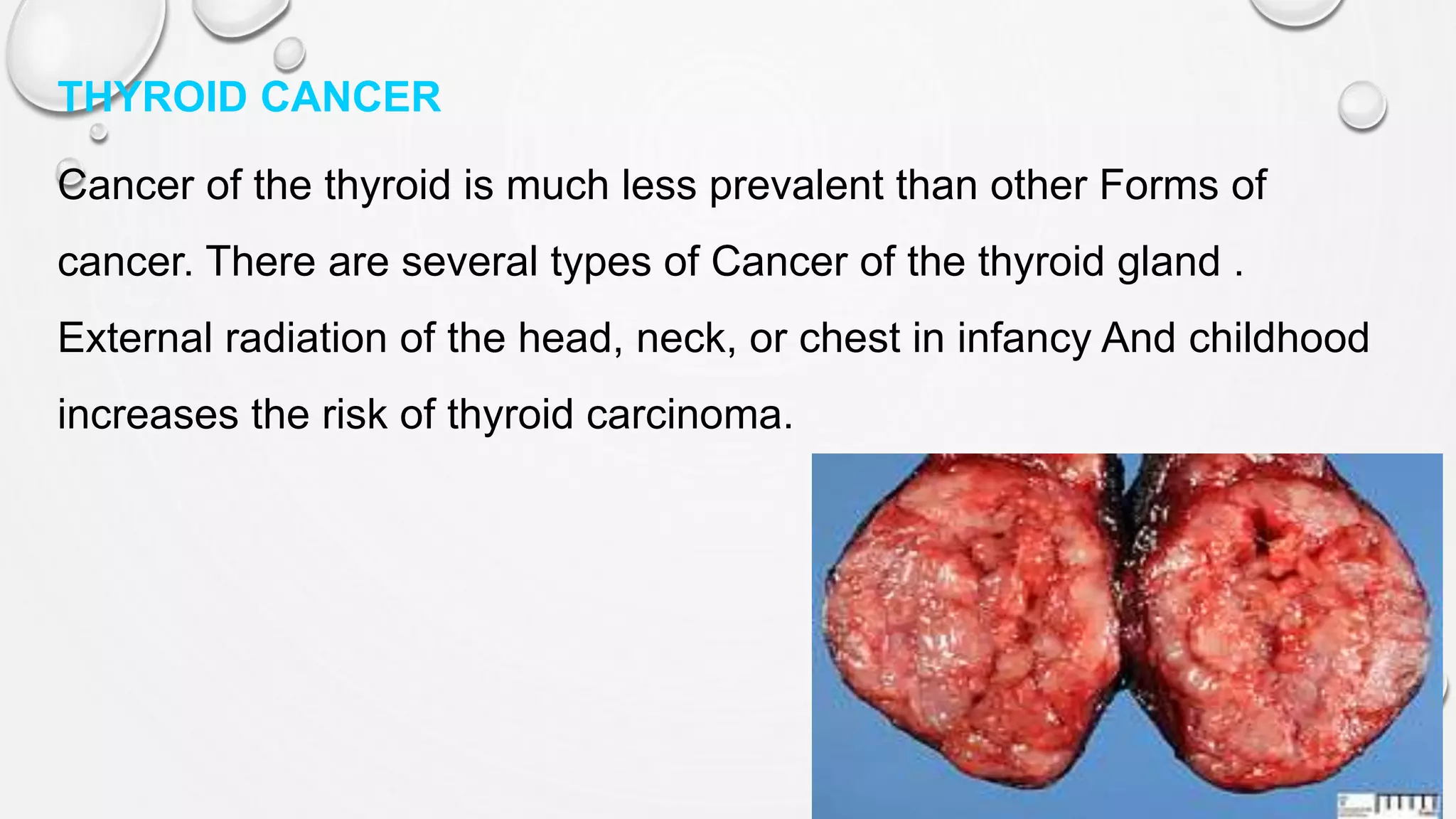 THYROID CANCER
Cancer of the thyroid is much less prevalent than other Forms of
cancer. There are several types of Cancer of the thyroid gland .
External radiation of the head, neck, or chest in infancy And childhood
increases the risk of thyroid carcinoma.
 
