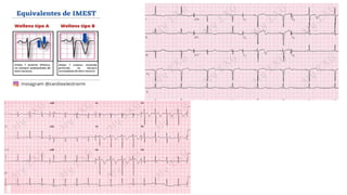 Infarto agudo al miocardio no st elevado | PPTX