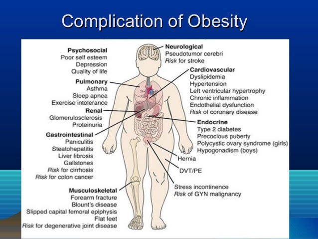 Morbid Obesity Diet And Exercise