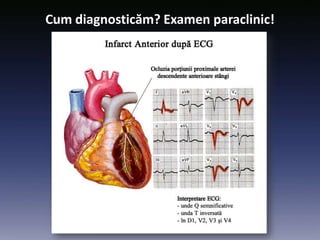 Cum diagnosticăm? Examen paraclinic!
 