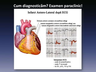 Cum diagnosticăm? Examen paraclinic!
 