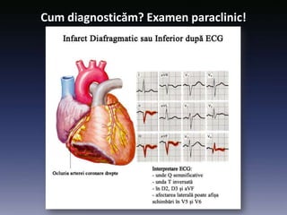 Cum diagnosticăm? Examen paraclinic!
 