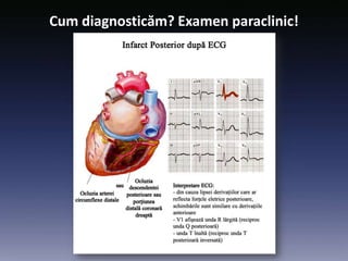 Cum diagnosticăm? Examen paraclinic!
 
