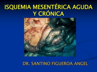 ISQUEMIA MESENTÉRICA AGUDA
Y CRÓNICA
DR. SANTINO FIGUEROA ANGEL
 