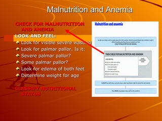 Malnutrition and Anemia CHECK FOR MALNUTRITION AND ANEMIA LOOK AND FEEL: Look for visible severe wasting Look for palmar pallor. Is it: Severe palmar pallor? Some palmar pallor? Look for edema of both feet Determine weight for age CLASSIFY NUTRITIONAL STATUS 
