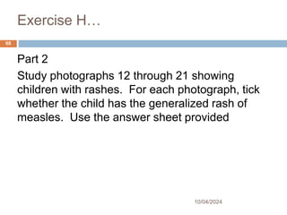 Exercise H…
10/04/2024
68
Part 2
Study photographs 12 through 21 showing
children with rashes. For each photograph, tick
whether the child has the generalized rash of
measles. Use the answer sheet provided
 