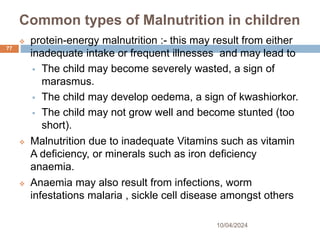 Common types of Malnutrition in children
10/04/2024
77
 protein-energy malnutrition :- this may result from either
inadequate intake or frequent illnesses and may lead to
 The child may become severely wasted, a sign of
marasmus.
 The child may develop oedema, a sign of kwashiorkor.
 The child may not grow well and become stunted (too
short).
 Malnutrition due to inadequate Vitamins such as vitamin
A deficiency, or minerals such as iron deficiency
anaemia.
 Anaemia may also result from infections, worm
infestations malaria , sickle cell disease amongst others
 