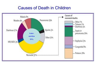 Causes of Death in Children
Under-
nutrition
53%
 