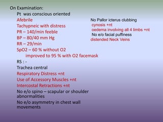 Feable Chest A case of Acute RVF | PPTX