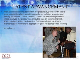 LATEST ADVANCEMENT
• With an onboard computer within the prosthesis, people with above-
knee amputations have greater control over walking, stopping and
moving on inclines. These “robotic” knees, termed microprocessor
knees, analyze the pressure an amputee puts on the missing limb.
Also contained within the knee is a fluid control unit, which the
microprocessor monitors to appropriate joint resistance when walking
on inclines.
 