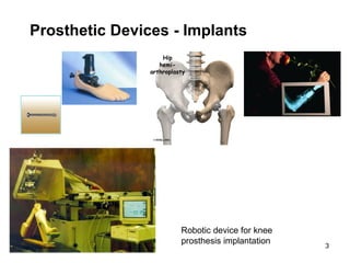 Carmel J Caruana Medical Physics IHC Univ of Malta
3
Prosthetic Devices - Implants
Robotic device for knee
prosthesis implantation
 
