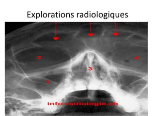 Explorations radiologiques
 