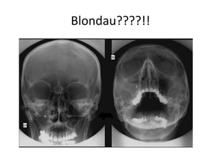 Blondau????!!
 