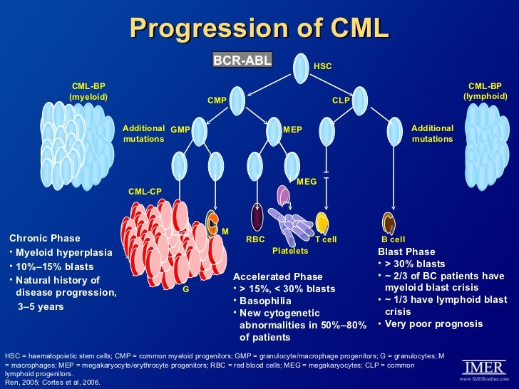 chronic myelogenous leukemia chronic myelogenous leukemia