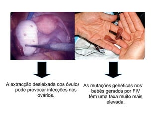 A extracção desleixada dos óvulos pode provocar infecções nos ovários. As mutações genéticas nos bebés gerados por FIV têm uma taxa muito mais elevada. 