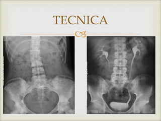 TECNICA
   
 