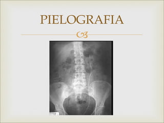 PIELOGRAFIA
     
 