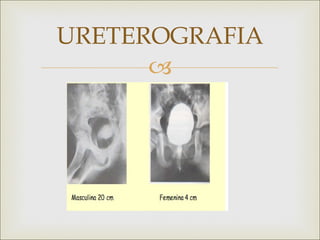 URETEROGRAFIA
      
 