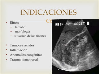 INDICACIONES
•   Riñón       
    – tamaño
    – morfología
    – situación de los riñones


•   Tumores renales
•   Inflamación
•   Anomalías congénitas
•   Traumatismo renal
 