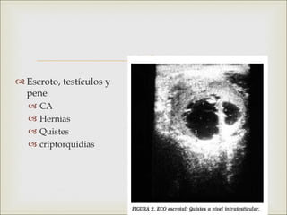 
 Escroto, testículos y
  pene
      CA
      Hernias
      Quistes
      criptorquidias
 