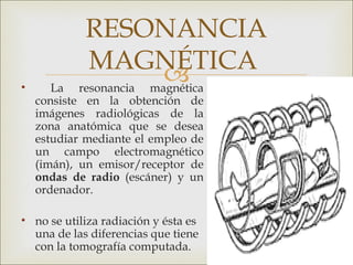 RESONANCIA
            MAGNÉTICA
                
•      La resonancia magnética
    consiste en la obtención de
    imágenes radiológicas de la
    zona anatómica que se desea
    estudiar mediante el empleo de
    un campo electromagnético
    (imán), un emisor/receptor de
    ondas de radio (escáner) y un
    ordenador.

• no se utiliza radiación y ésta es
  una de las diferencias que tiene
  con la tomografía computada.
 
