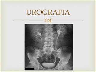 UROGRAFIA
   
 