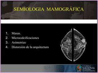 SEMIOLOGIA MAMOGRÁFICA
1. Masas.
2. Microcalcificaciones
3. Asimetrias
4. Distorsión de la arquitectura
 