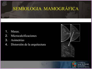 SEMIOLOGIA MAMOGRÁFICA
1. Masas.
2. Microcalcificaciones
3. Asimetrias
4. Distorsión de la arquitectura
 