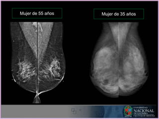 Mujer de 55 años Mujer de 35 años
 