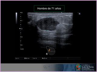 Hombre de 71 años
 