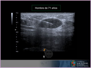 Hombre de 71 años
 