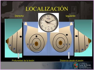 LOCALIZACIÓN
Derecho Izquierdo
Profundidad de la lesión Distancia desde el pezón
 