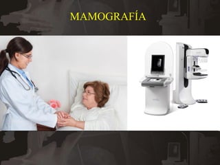 7
MAMOGRAFÍA
 
