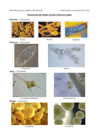 SESO DEL IES LAS CUMBRES. GRAZALEMA             CIENCIAS DE LA NATURALEZA 1º ESO

                    IMÁGENES DE SERES VI...