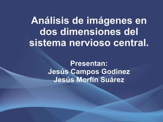 Análisis de imágenes en dos dimensiones del sistema nervioso central. Presentan: Jesús Campos Godinez Jesús Morfín Suárez 
