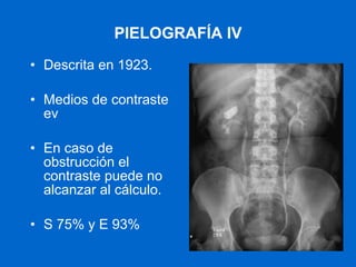 PIELOGRAFÍA IV Descrita en 1923. Medios de contraste ev En caso de obstrucción el contraste puede no alcanzar al cálculo. S 75% y E 93% 