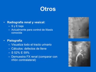 Otros Radiografía renal y vesical:  S y E baja Actualmente para control de litiasis conocida Pielografía Visualiza todo el tracto urinario Cálculos: defectos de llene S 52% E 59%  Demuestra FX renal (comparar con riñón contralateral) 