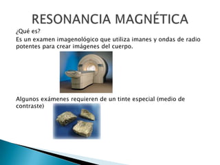 ¿Qué es?
Es un examen imagenológico que utiliza imanes y ondas de radio
potentes para crear imágenes del cuerpo.




Algunos exámenes requieren de un tinte especial (medio de
contraste)
 
