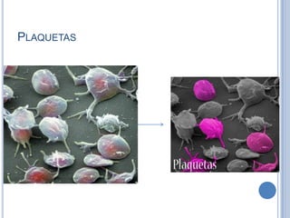 PLAQUETAS
 