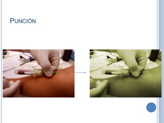 PUNCIÓN
 