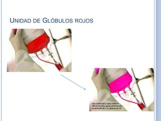 UNIDAD DE GLÓBULOS ROJOS
 
