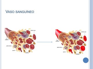 VASO SANGUÍNEO
 