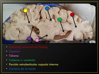 im-genes-neuroanatomicas-corte-axial-pdf