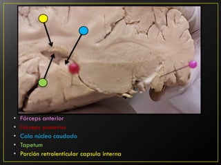 im-genes-neuroanatomicas-corte-axial-pdf